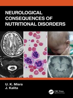 cover image of Neurological Consequences of Nutritional Disorders